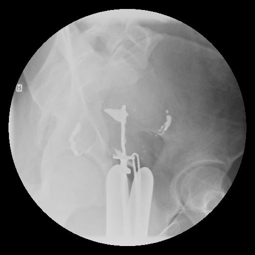 3.gif