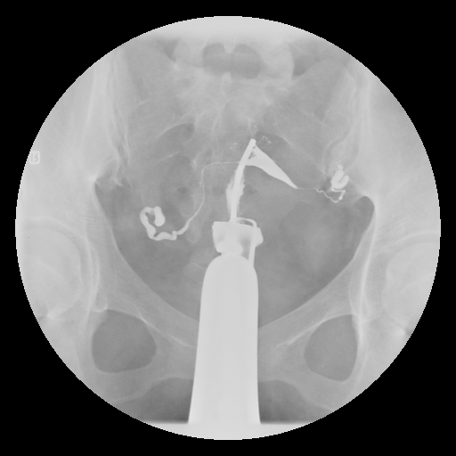 2.gif