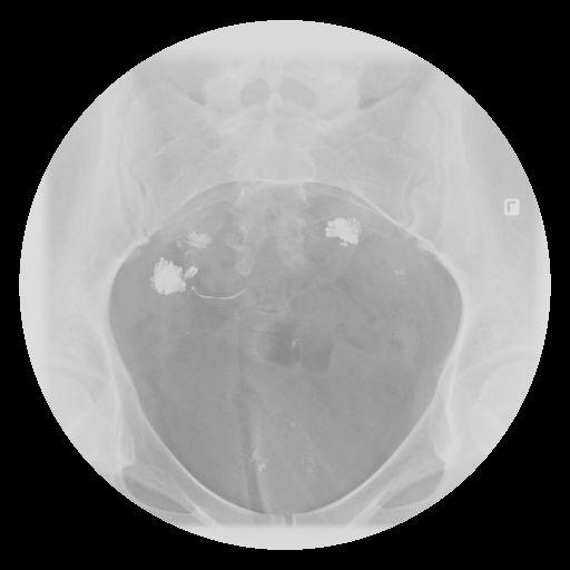 4.gif