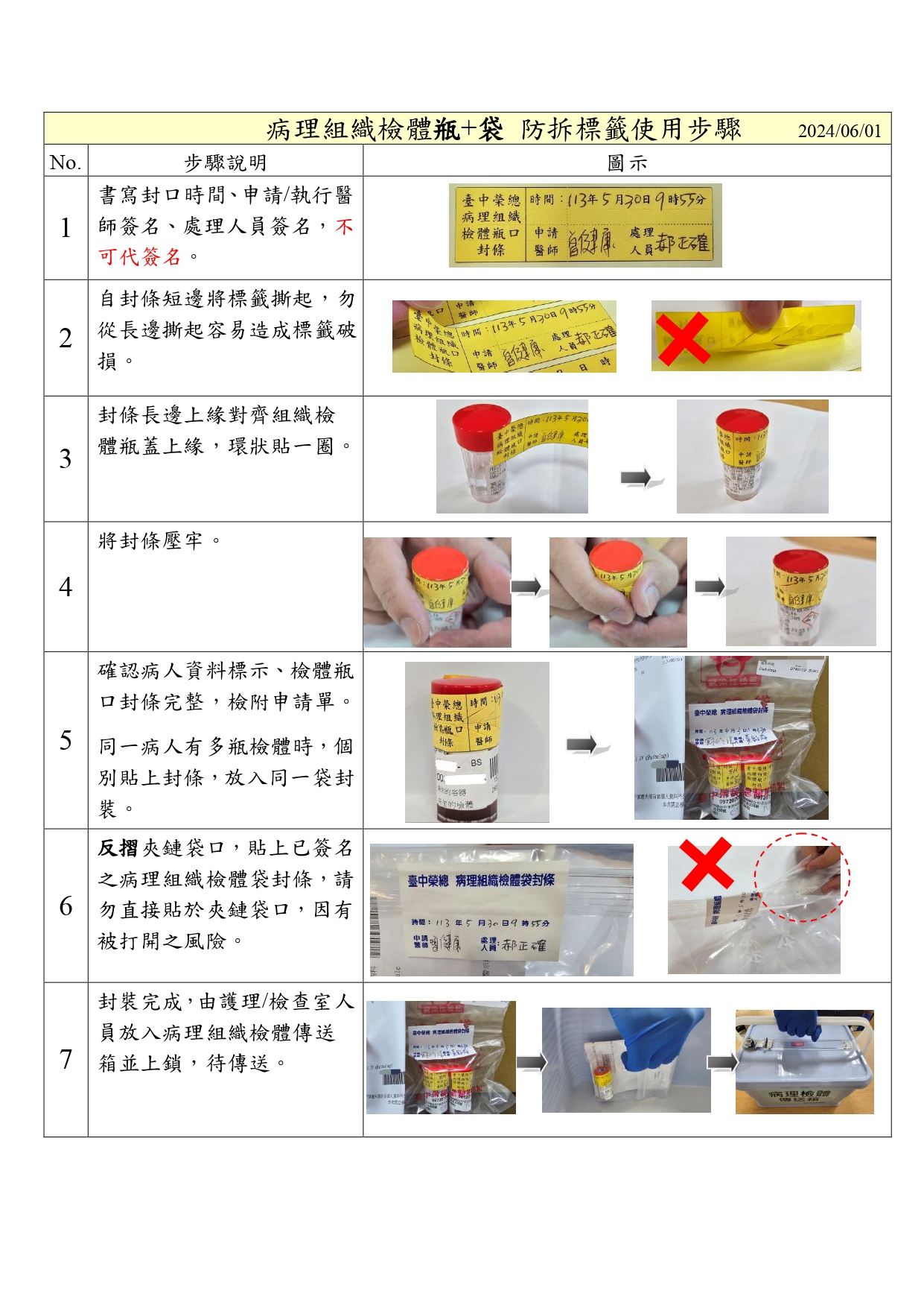病理組織檢體防拆標籤使用步驟-1.jpg