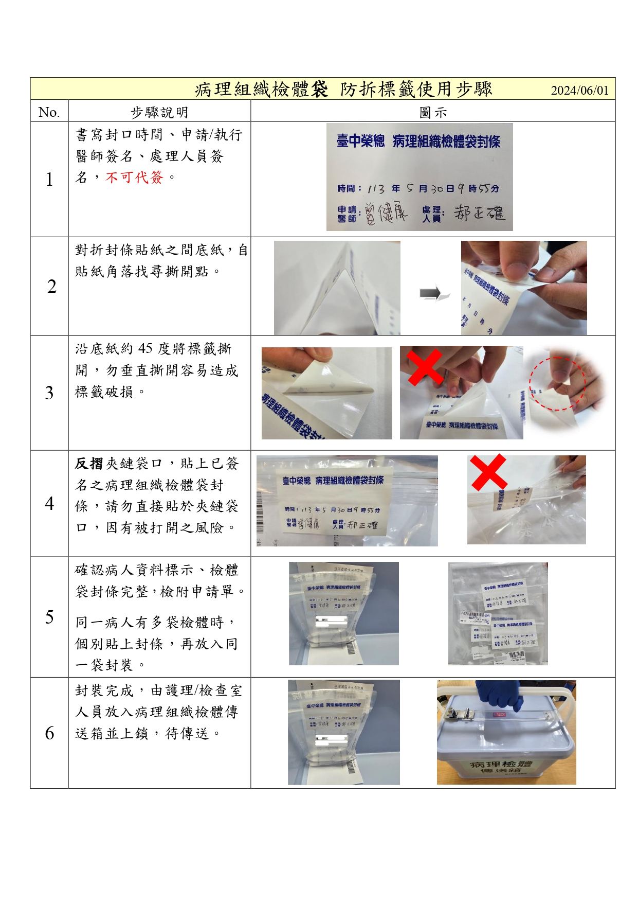 病理組織檢體防拆標籤使用步驟-2.jpg