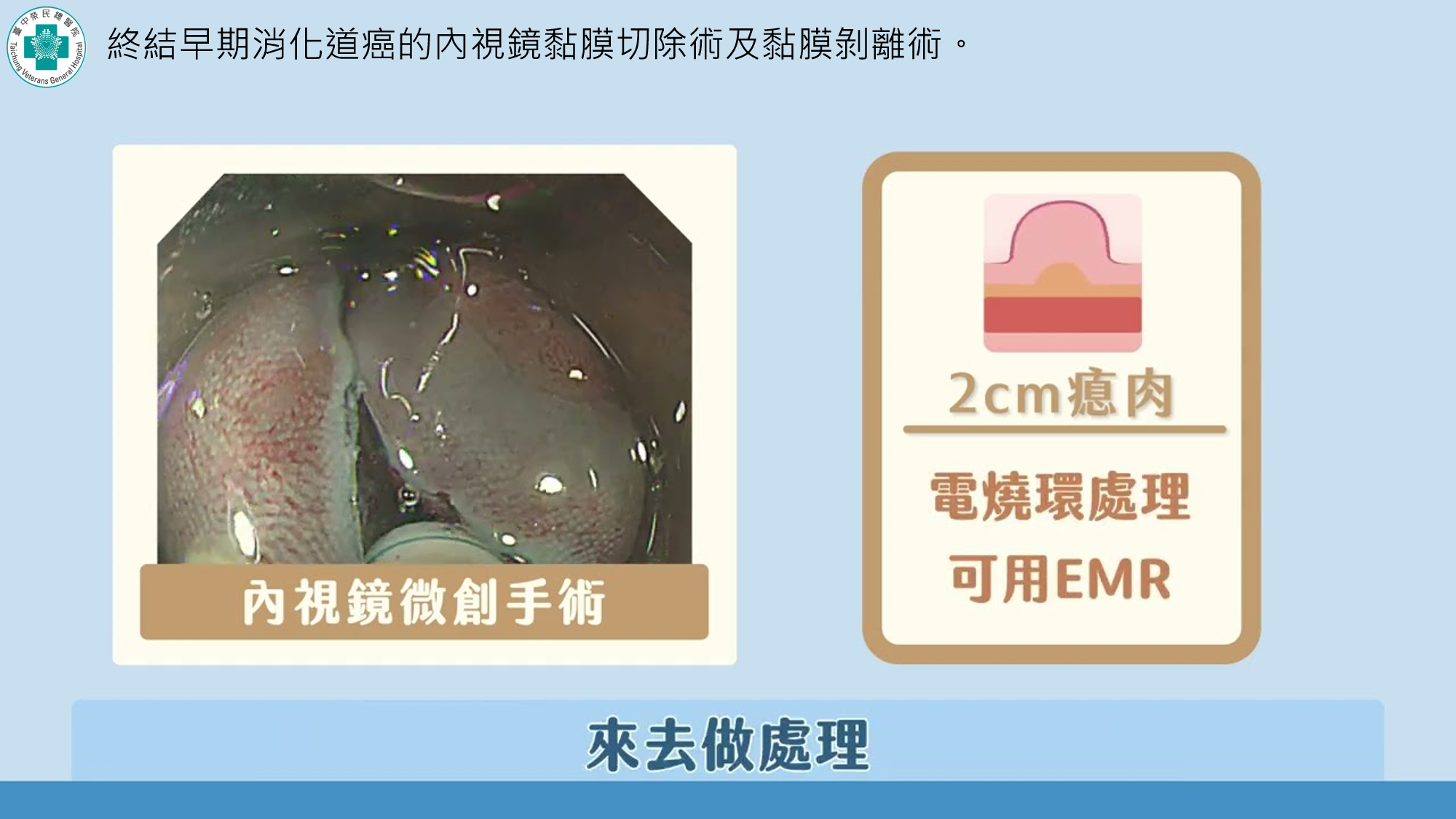 影片縮圖.png