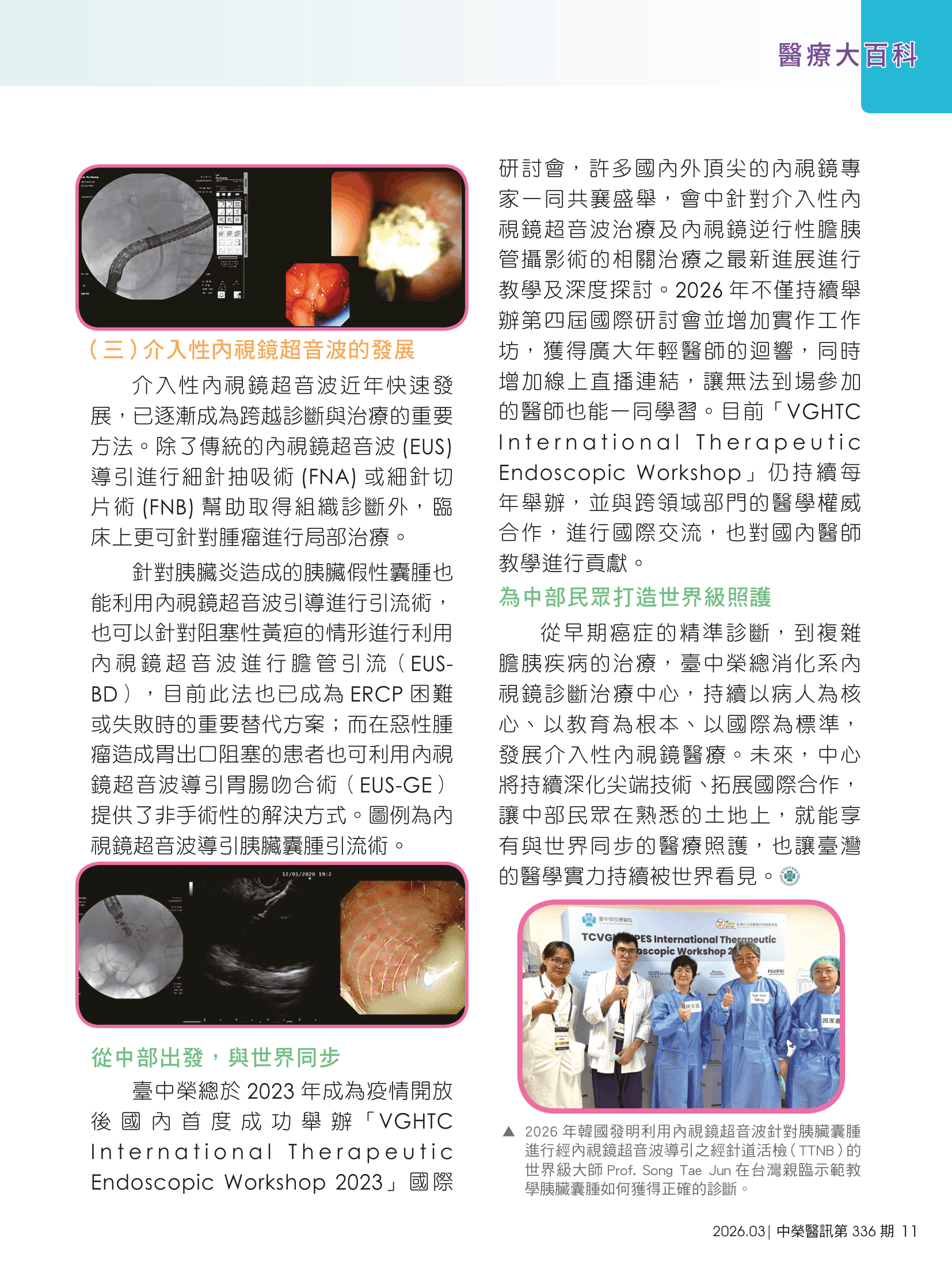 中榮醫訊月刊電子報336期-以內視鏡守護消化健康,中榮介入性內視鏡治療的臨床實力與國際視野-2.png