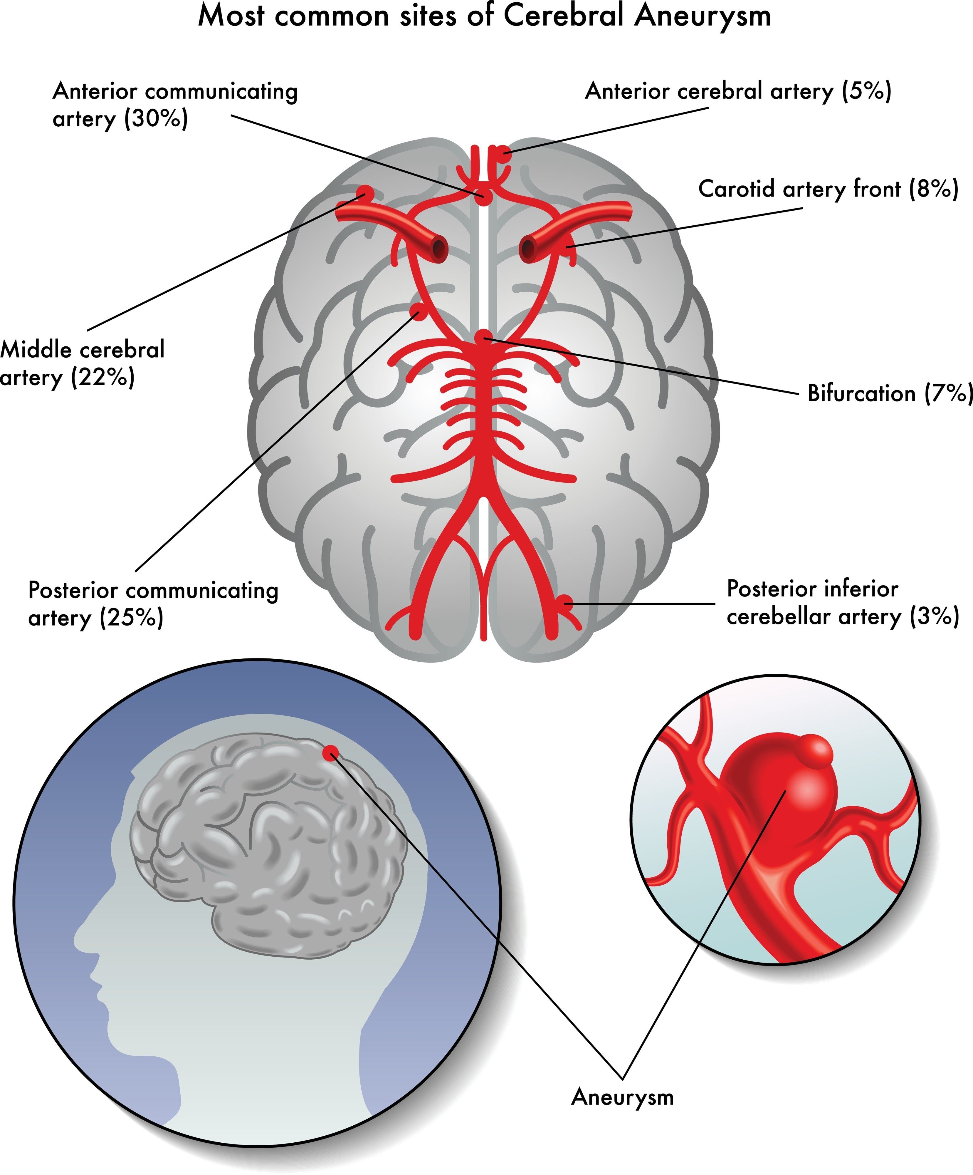 brain vessel