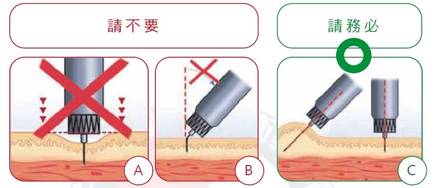 胰島素9.jpg