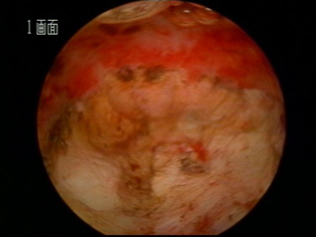 右下.jpg